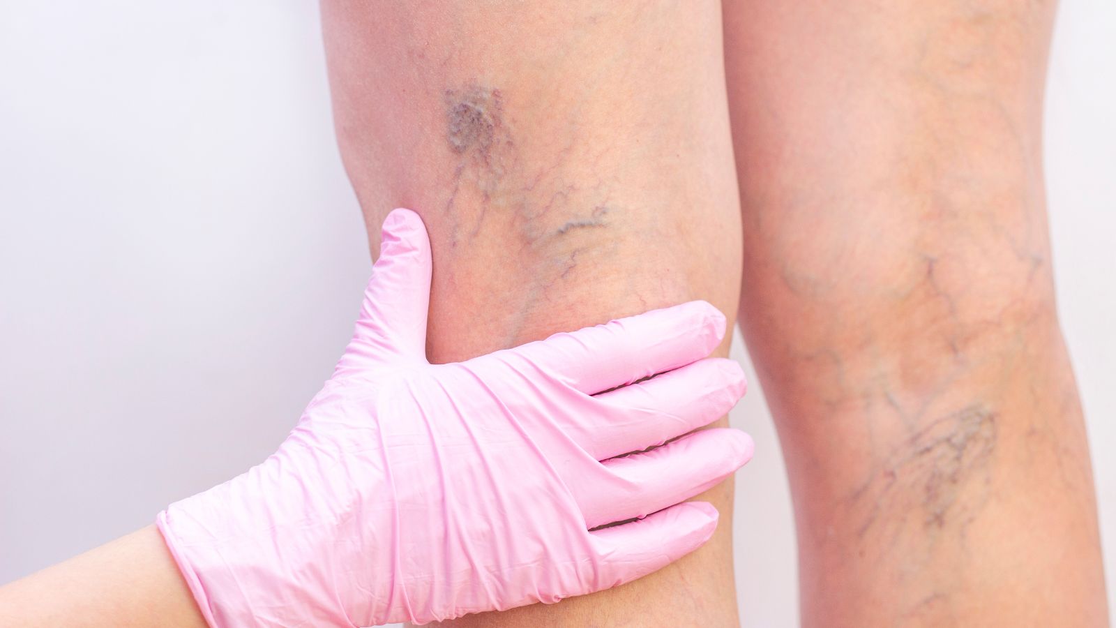 vein specialist near me
